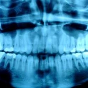 rayos x dental