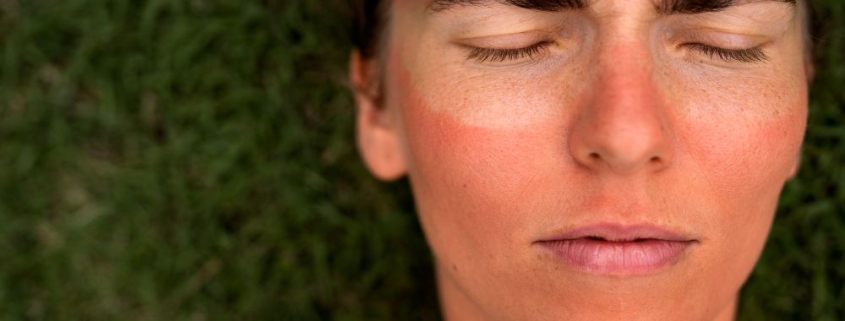 Consejos para cuidar la piel en verano: prevención del cáncer de piel 1 ciclo formativo en sanidad